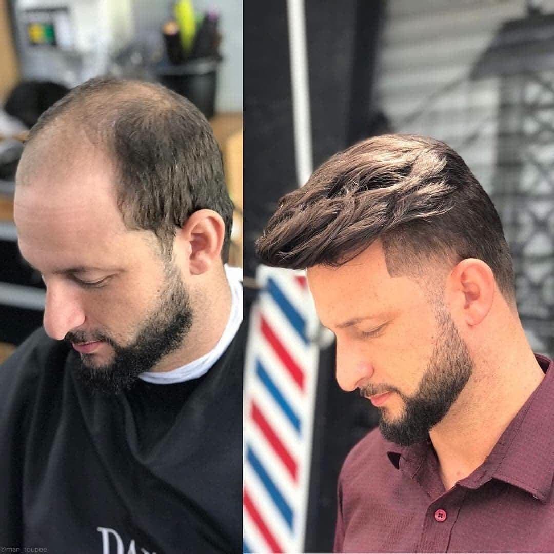 do i need a wig cap - How to decide, choose and wear one for comfort and flawless styling