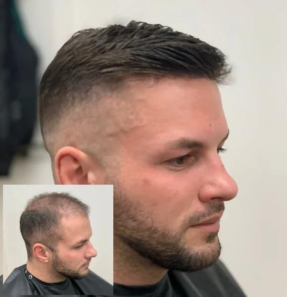 What Wigs Look Most Natural Discover Expert Tips on Lace Fronts Human Hair Blends and Styling for Undetectable Results