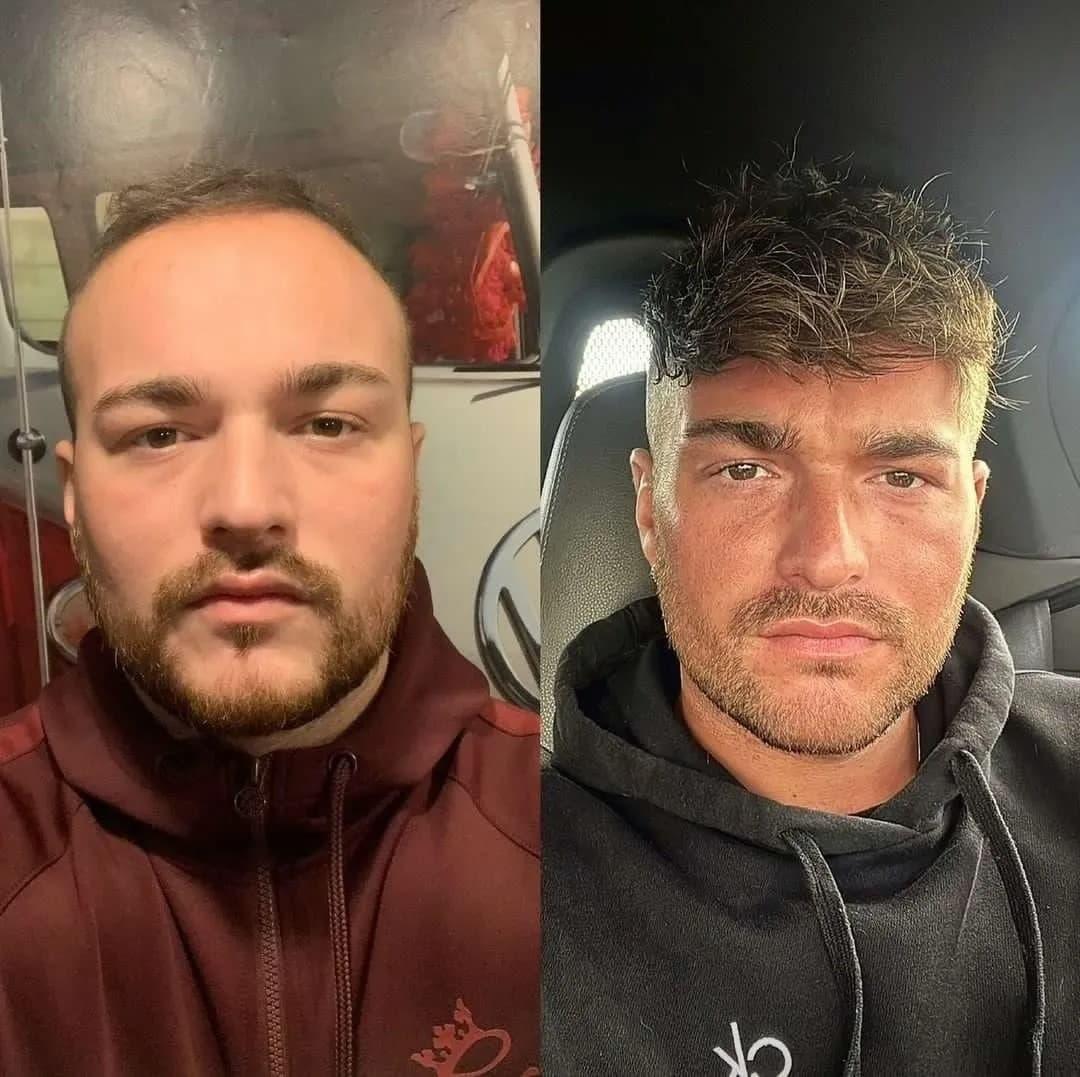 How to Put on a Wig with Thick Hair Expert Step by Step Tips for a Secure Natural Look