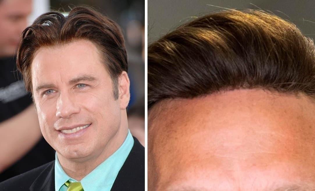 Investigating why did lyle menendez need a wig and how experts and records explain it